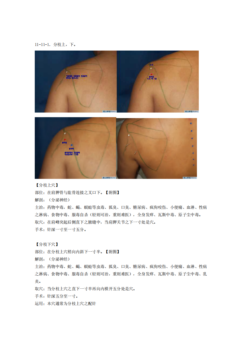 童氏奇穴发挥整理11-11.pdf 第1页