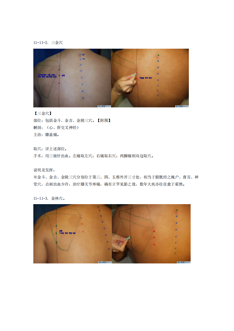 童氏奇穴发挥整理11-11.pdf 第2页