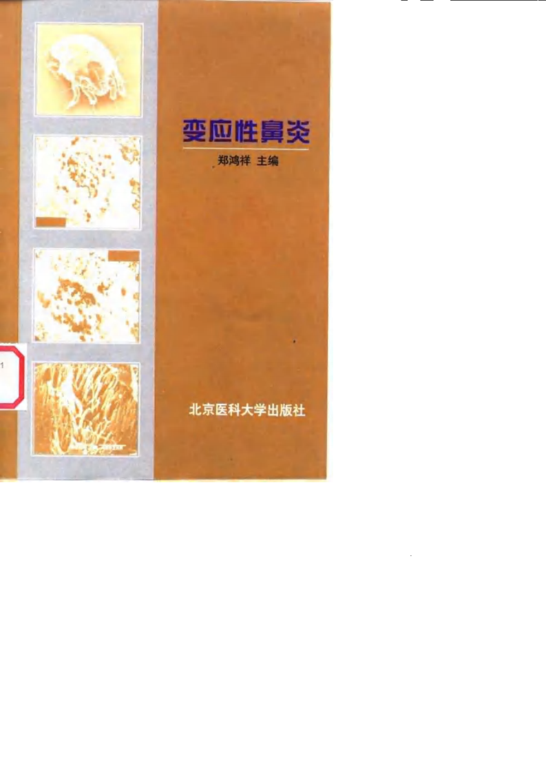 变应性鼻炎（扫描版）.pdf 第1页