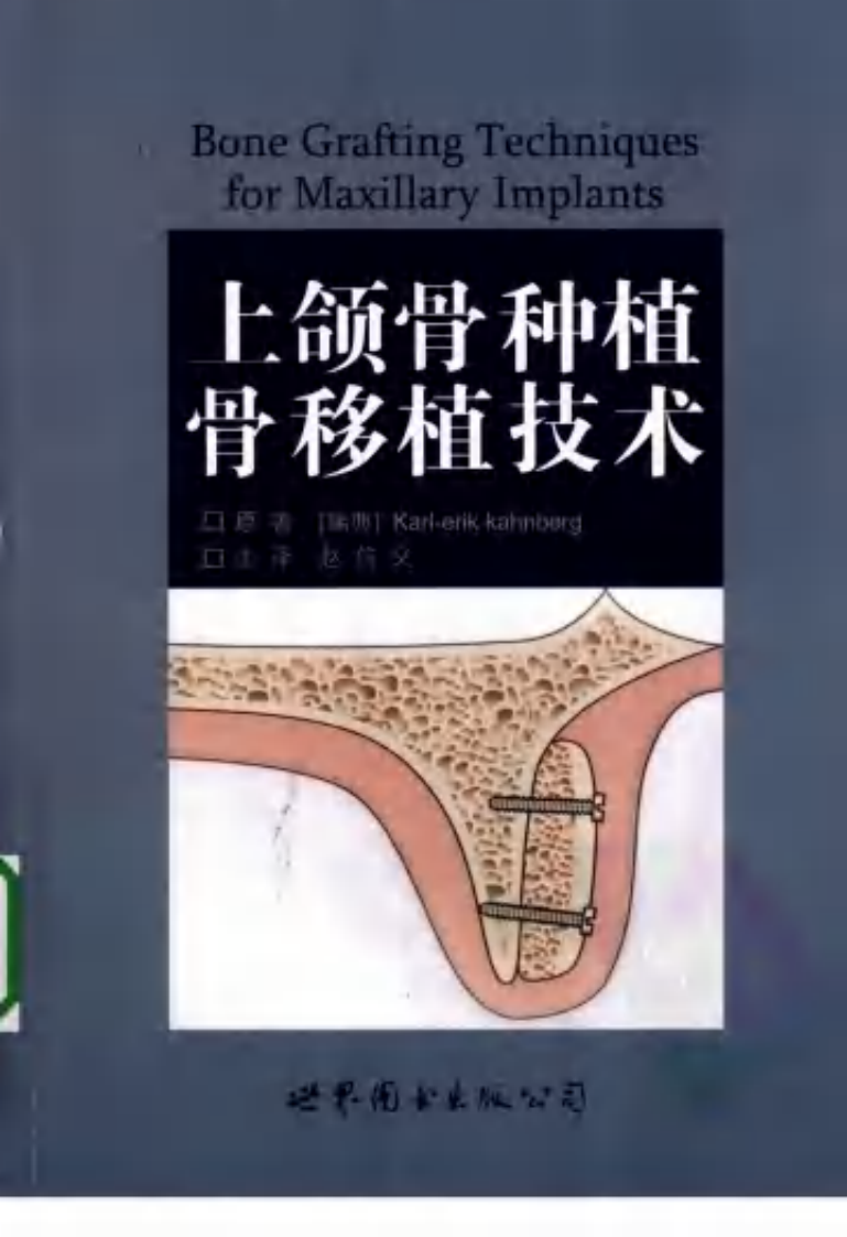 大川分享_上颌骨种植骨移植技术_.pdf 第1页