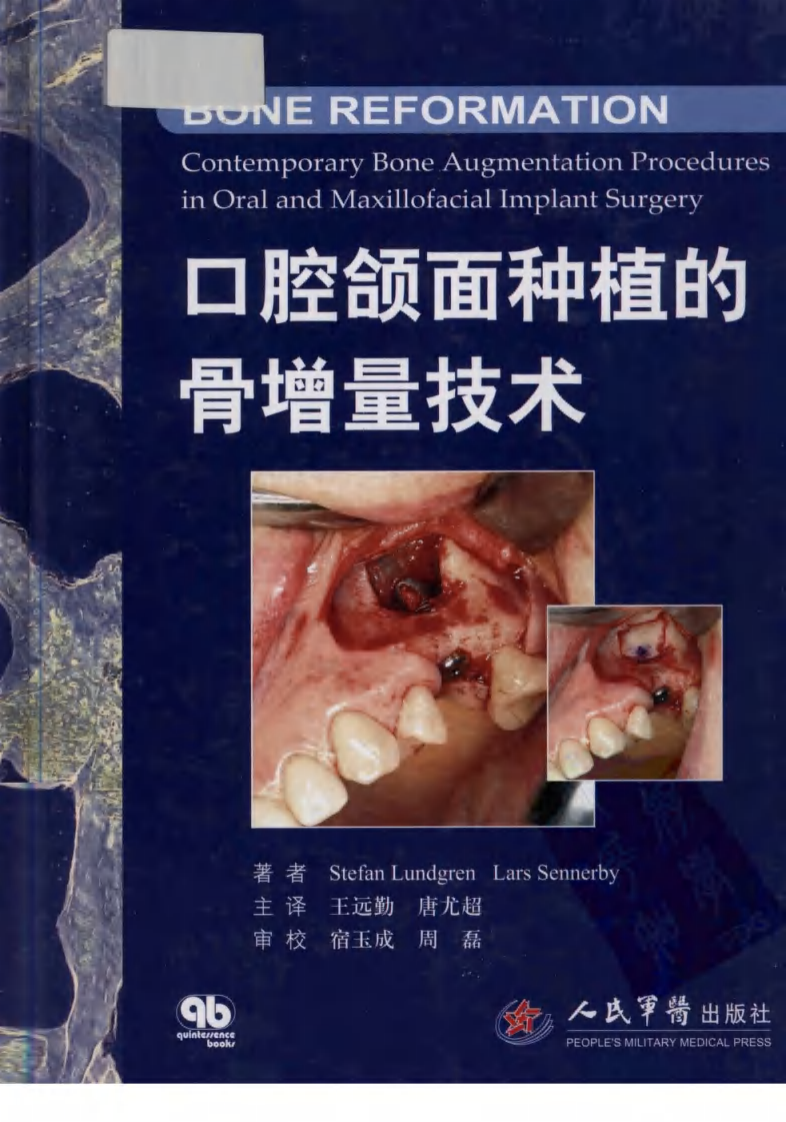 大川分享_口腔颌面种植的骨增量技术_.pdf 第1页