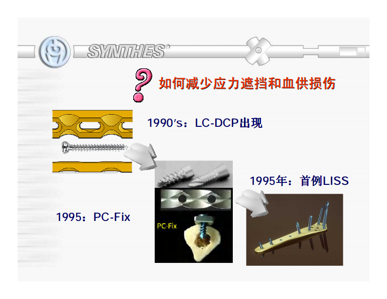 AO-钢板螺钉使用原则和方法  辛迪思LCP、LISS和MIPPO.pdf 第4页