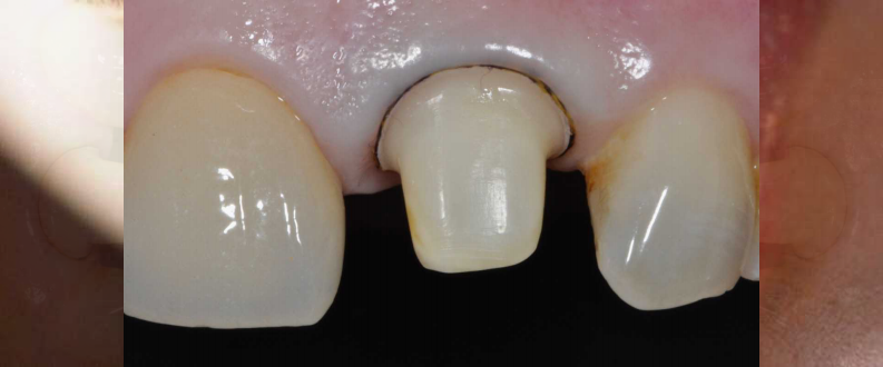 后牙讲座1.pdf 第4页