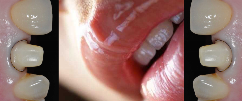 后牙讲座1.pdf 第2页