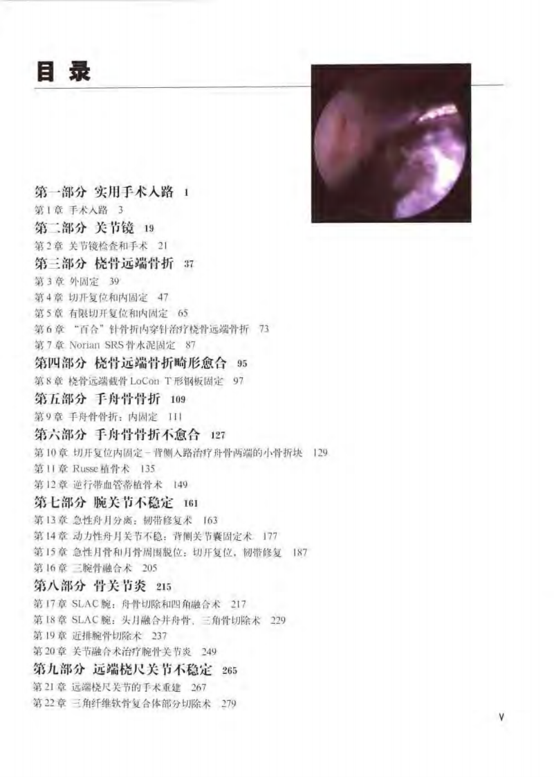 骨科标准手术技术丛书—腕.pdf 第2页