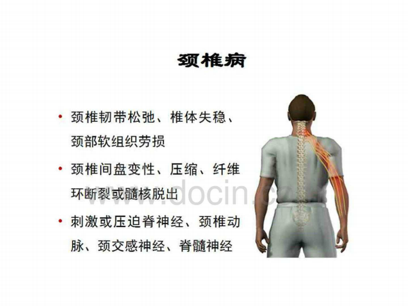 专家图解颈椎病的预防与保健.pdf 第4页