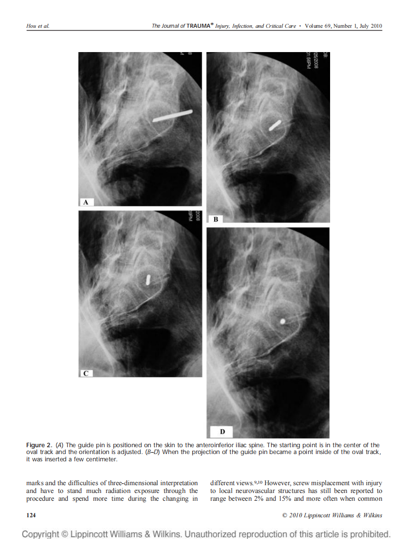 骶1椎弓根轴位 侯志勇.pdf 第3页