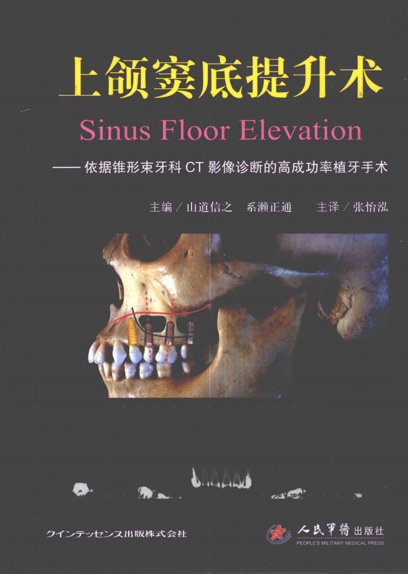 082上颌窦底提升术.pdf 第1页