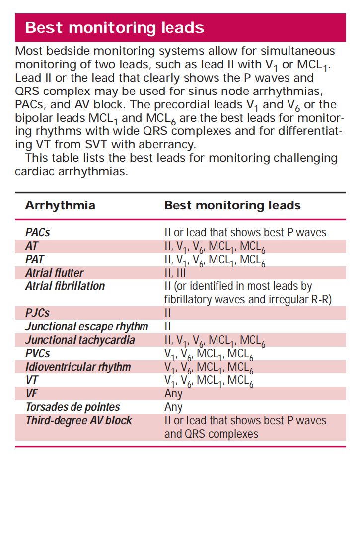 快速检查心电图（2010高清英文版）ECG Facts Made Incredibly Quick!, 2nd Ed.pdf 第5页