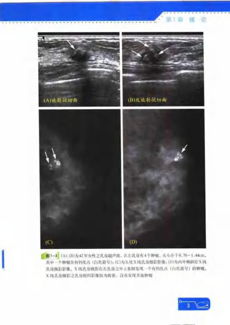实用乳腺超声波技术判读.pdf 第5页