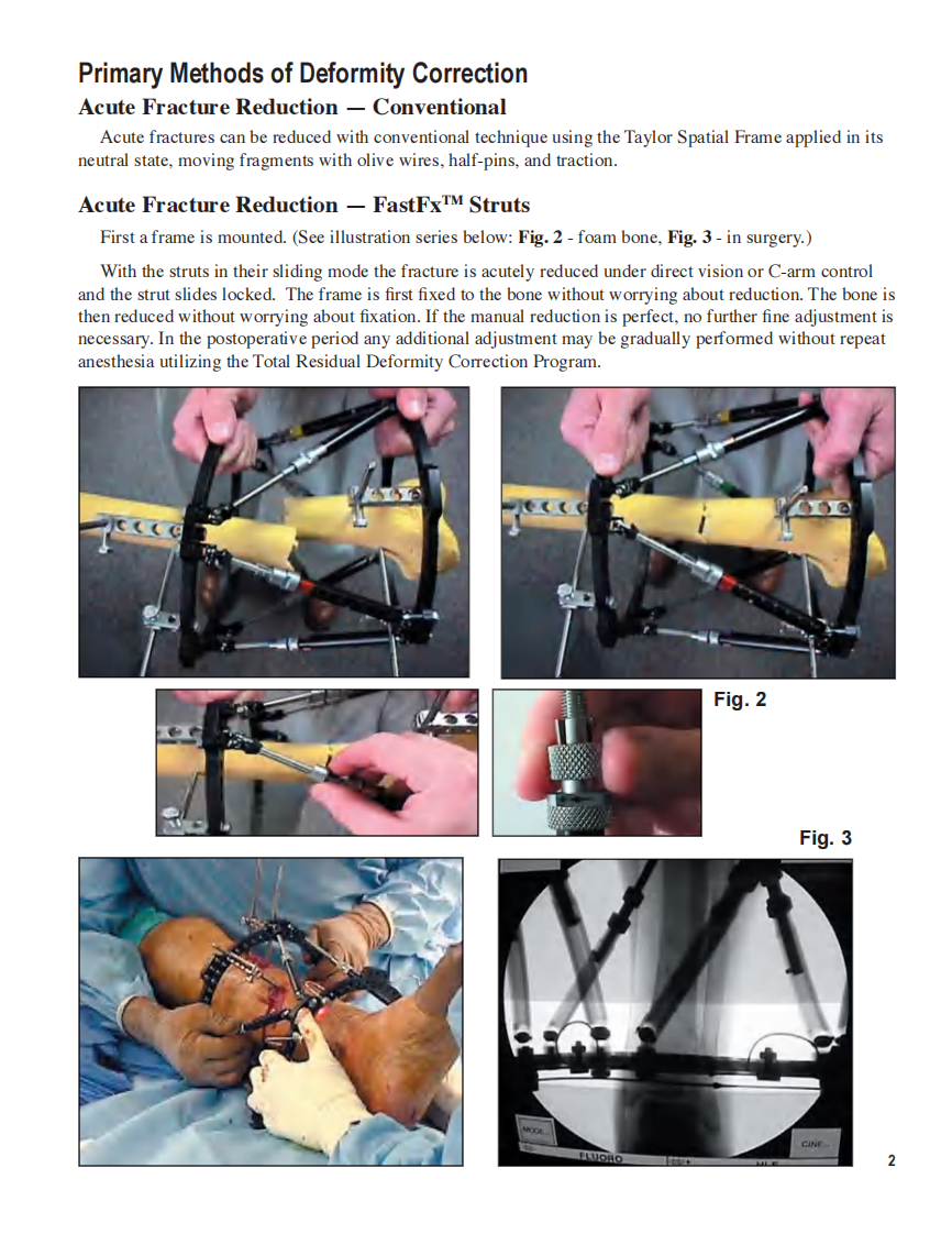 泰勒支架说明书.pdf 第3页