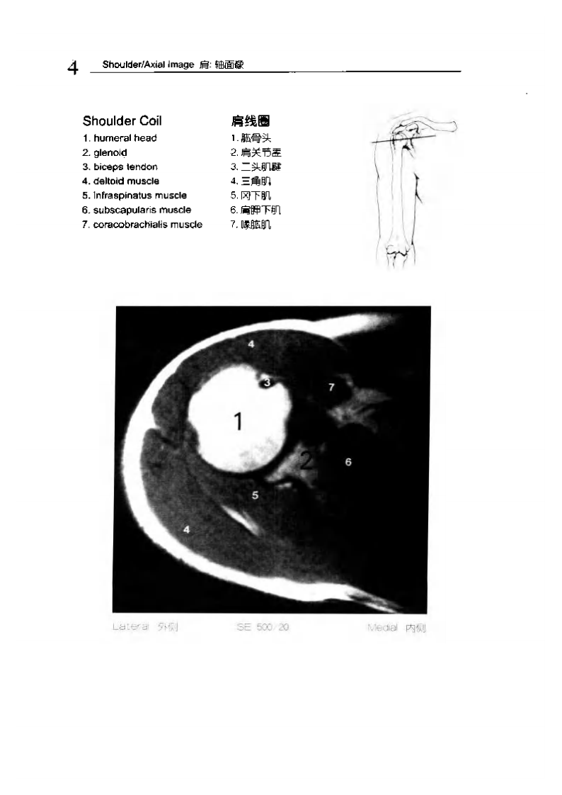 人体MRI图谱.pdf 第4页
