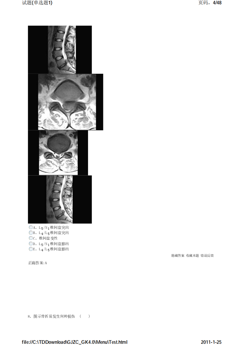 考试宝典 医学高级职称考试 骨科 单选题1.pdf 第4页