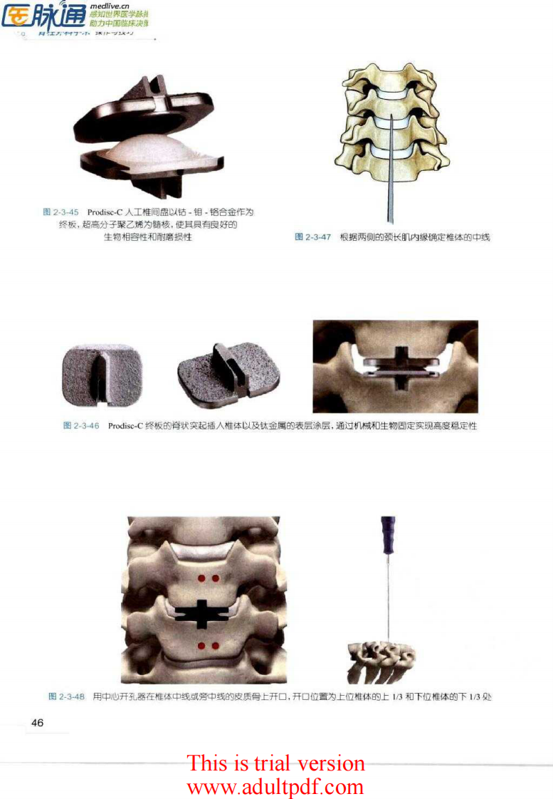 脊柱外科手术操作与技巧（骨科手术技巧丛书）2.pdf 第2页