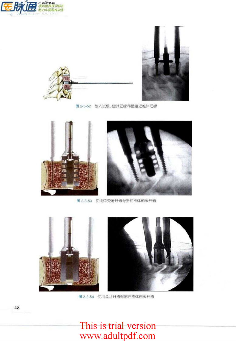 脊柱外科手术操作与技巧（骨科手术技巧丛书）2.pdf 第4页