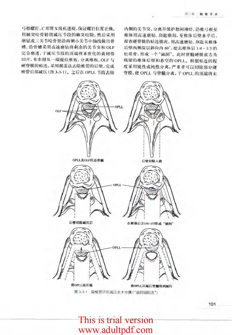 脊柱外科手术操作与技巧（骨科手术技巧丛书）3.pdf 第2页