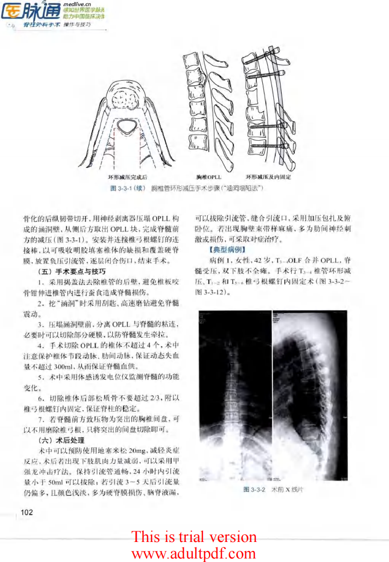 脊柱外科手术操作与技巧（骨科手术技巧丛书）3.pdf 第3页