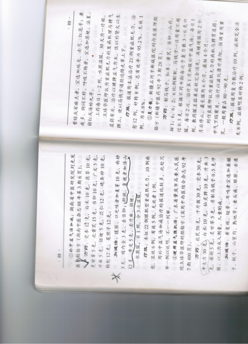 重症肌无力.pdf 第5页