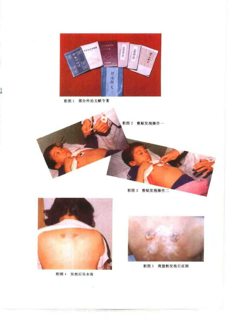 中国外治疗法（王小平）.pdf 第5页