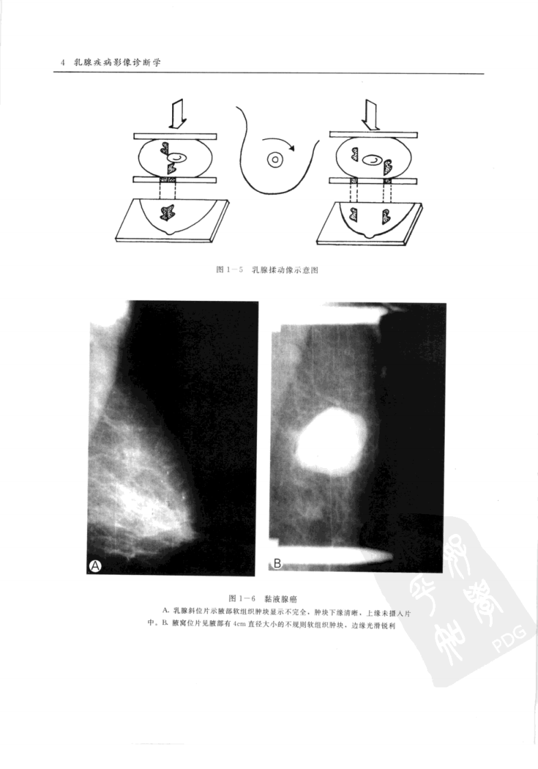杜红文，张蕴主编.+乳腺疾病影像诊断学.+西安市：陕西科学技术出....pdf 第4页