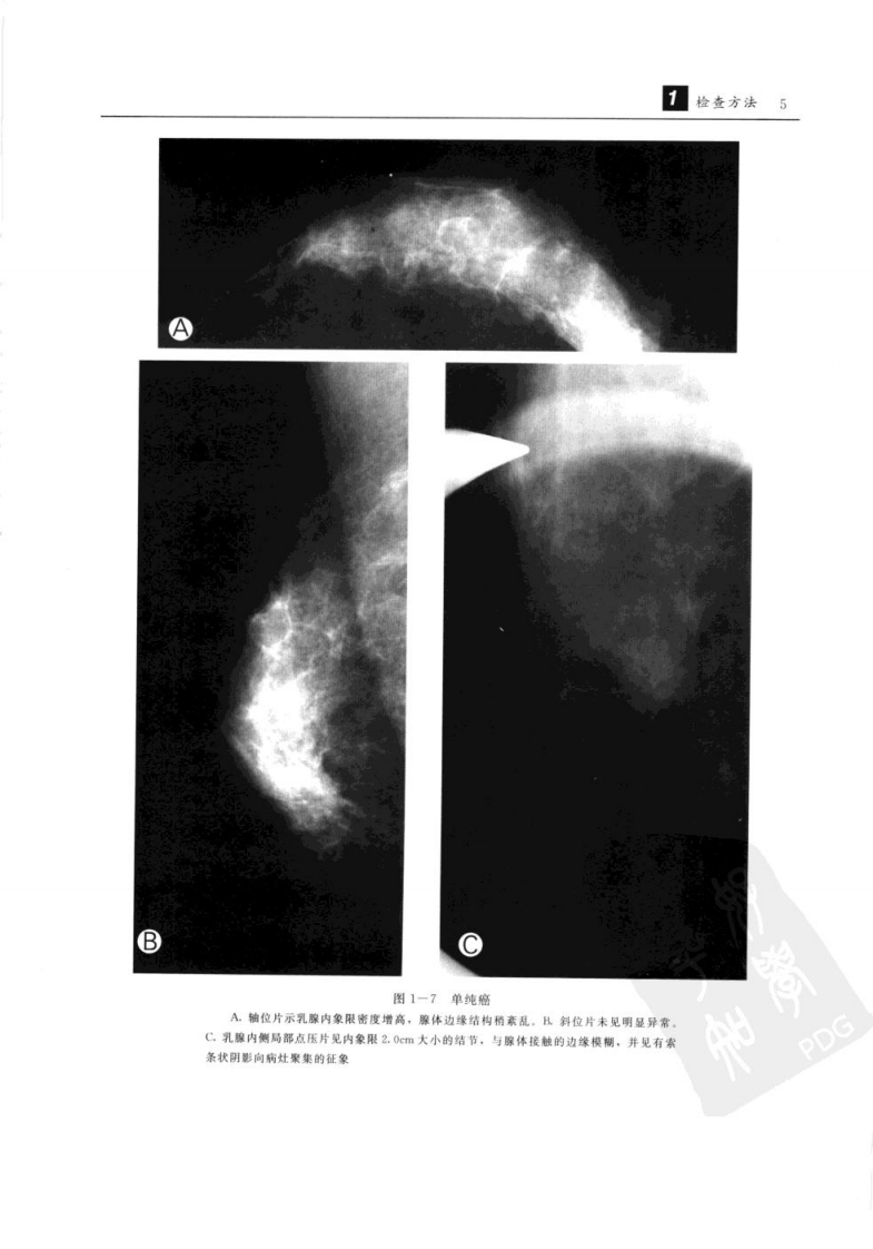 杜红文，张蕴主编.+乳腺疾病影像诊断学.+西安市：陕西科学技术出....pdf 第5页