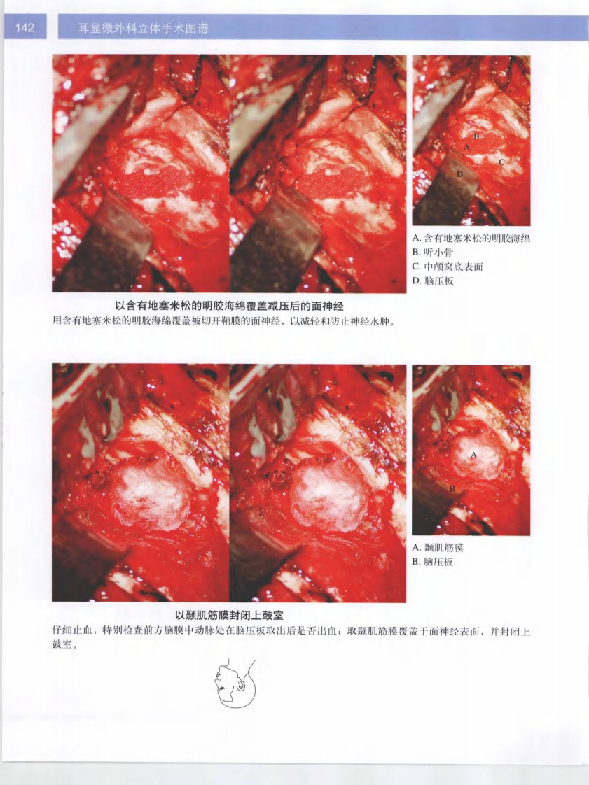 耳显微外科立体手术图谱2.pdf 第2页