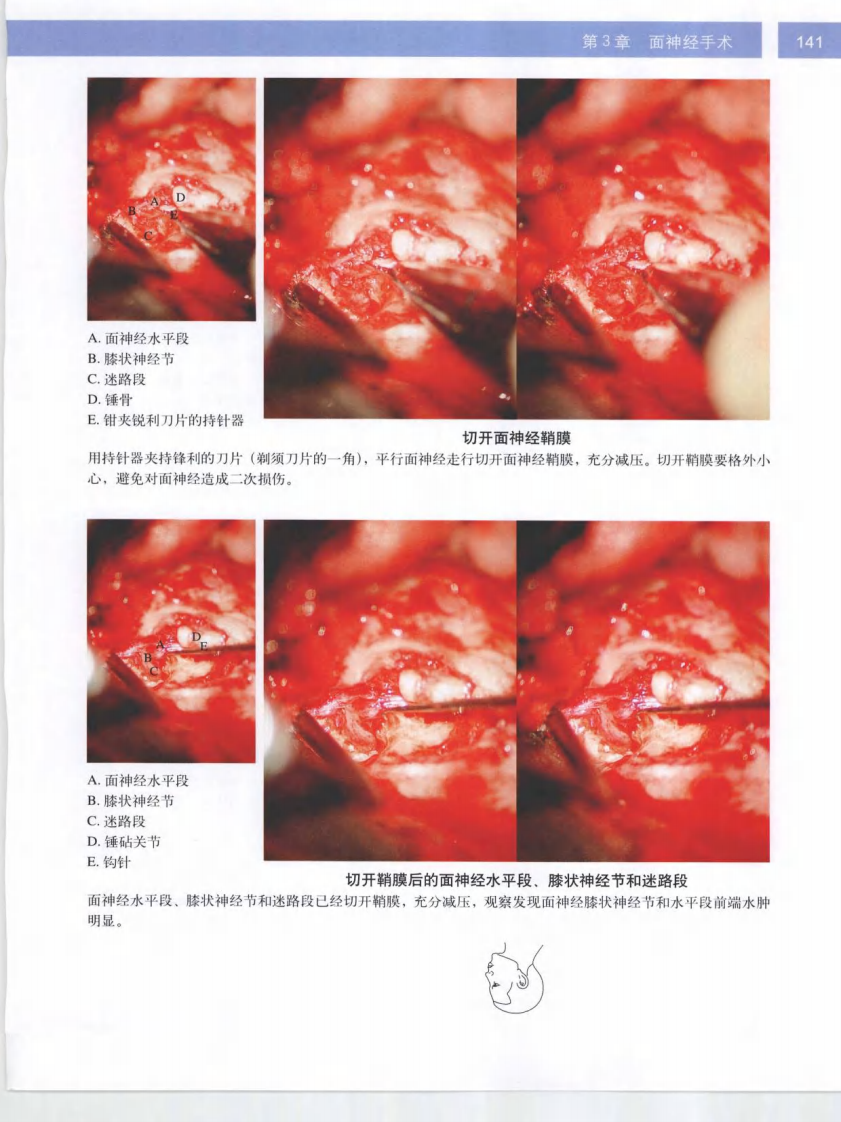 耳显微外科立体手术图谱2.pdf 第1页