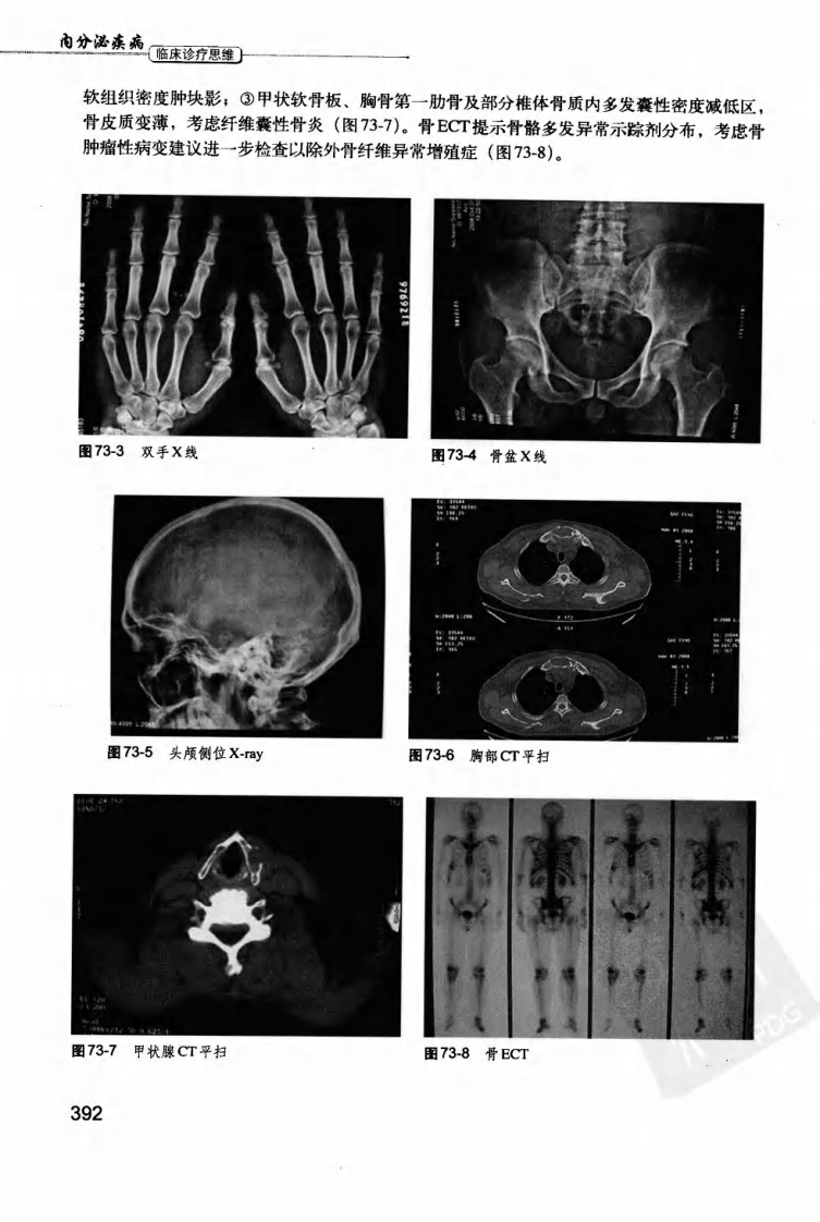 内分泌疾病临床诊疗思维-401-522.pdf 第2页