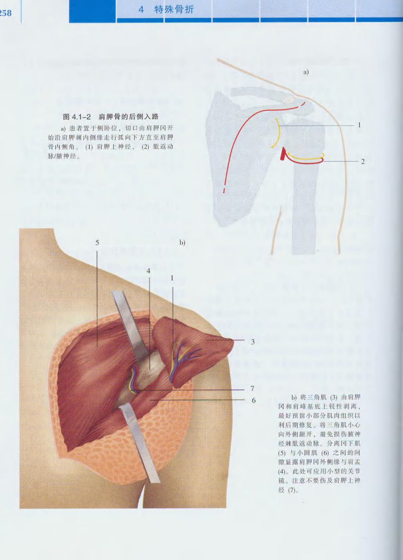 骨折治疗的AO原则（中）（高清版）.pdf 第5页