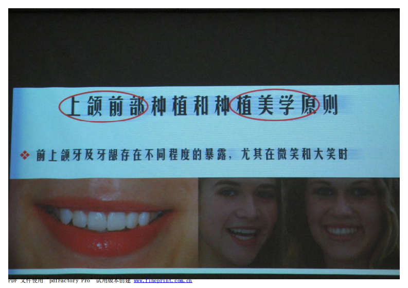 152宿玉成 上颌前部种植和种植美学原则.pdf 第3页