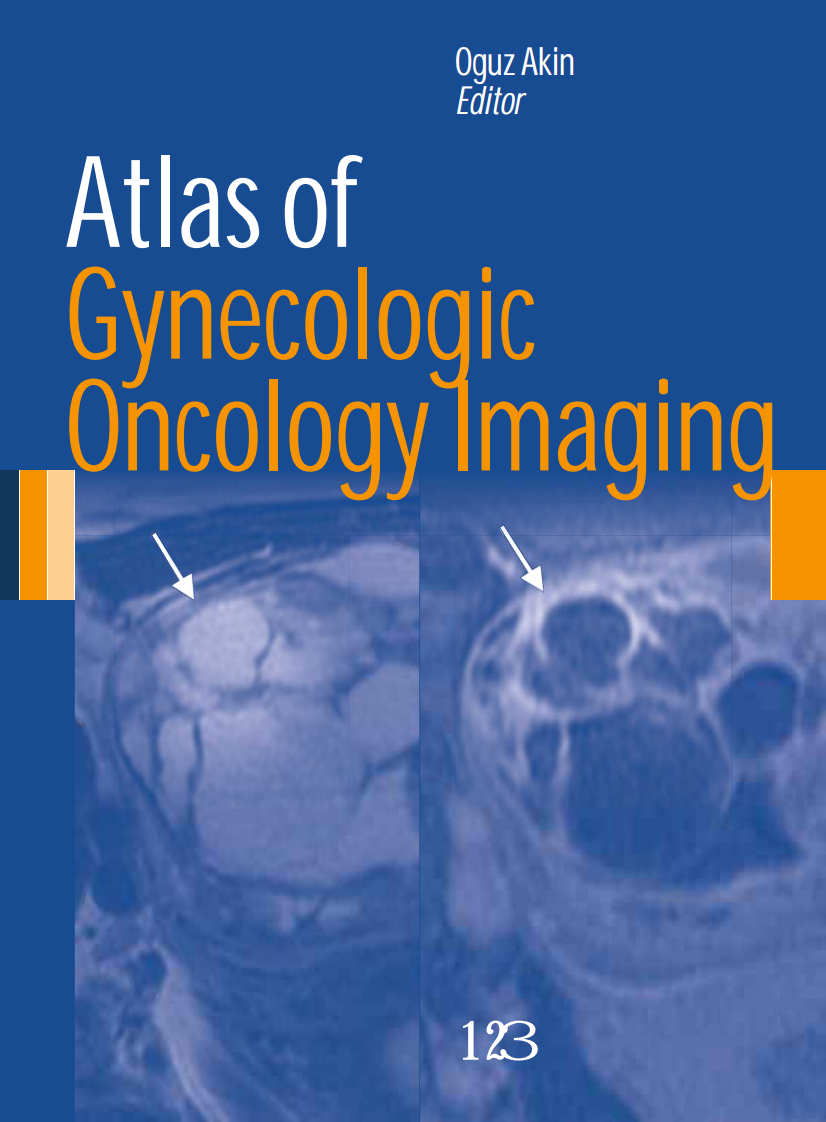 Atlas妇科肿瘤成像（2013高清英文版）Atlas of Gynecologic Oncology Imaging.pdf 第1页