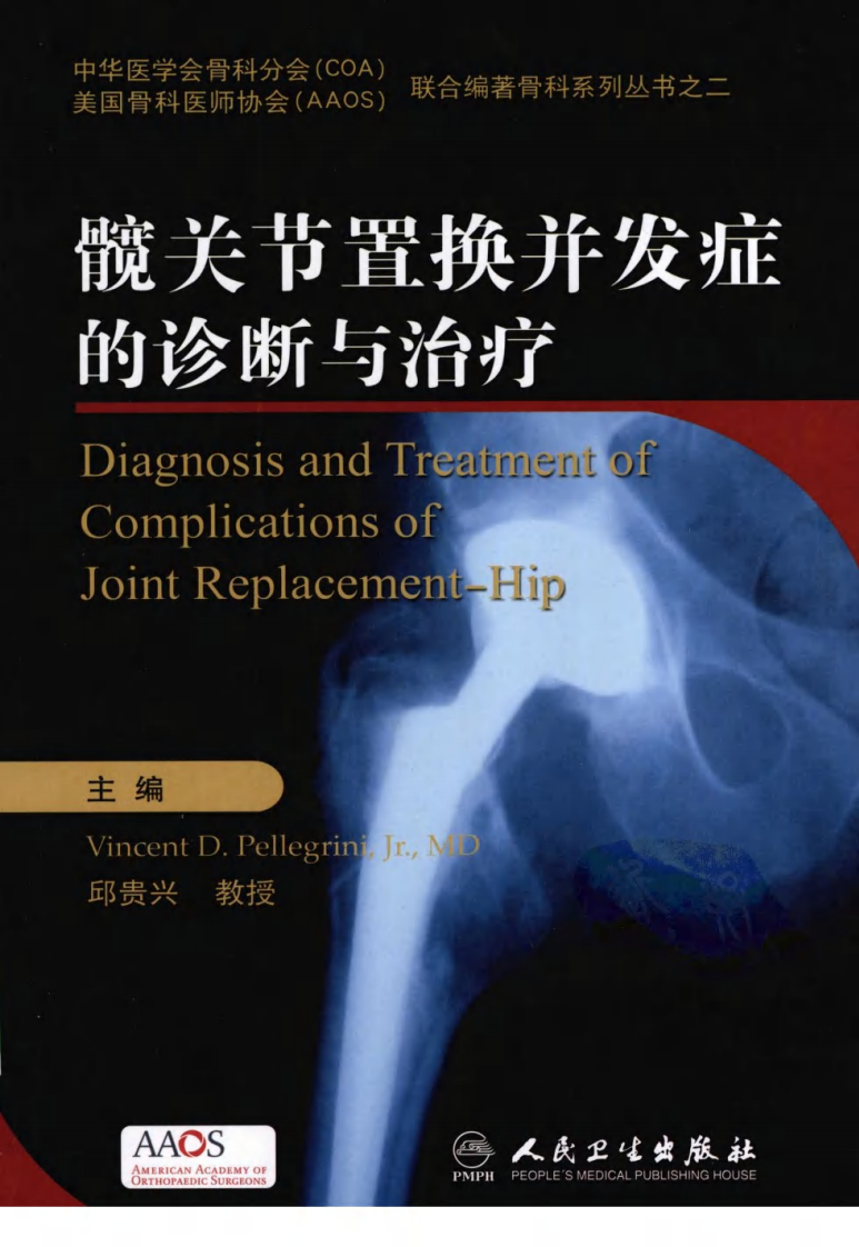 髋关节置换并发症的诊断与治疗.pdf 第1页