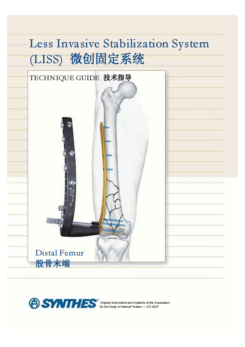 AO-LISS钢板系统固定技术详解.pdf 第1页